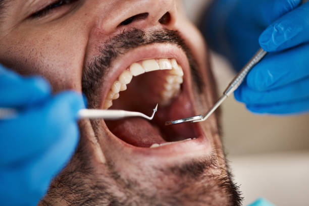 Best Cracked Tooth Emergency Dentist  in Upper Greenwood Lake, NJ