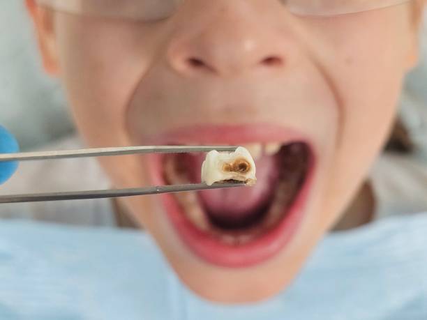 Best Knocked-Out Tooth Emergency  in Upper Greenwood Lake, NJ